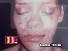 Rihanna pic after Chris Brown hit her