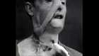 Haunting Photos Of WW1 Plastic Surgery - MR_rusty Original