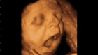 The 3D/4D ultrasound scans capture video