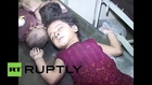 Pakistan: Gujranwala 'Christian' arson victims receive hospital treatment *GRAPHIC*