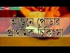 Primary Treatment for Burned Patient Bangla Health Tips