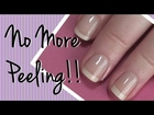 How I Fixed My Peeling Nails!  Nail Care Video by ArcadiaNailArt