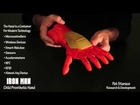 3D Printed IRON MAN Child Prosthetic Hand