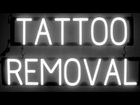 Laser Tattoo Removal Richmond VA Tattoo Removal